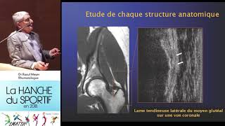 Tendinite psoas et moyen fessier et sport Extrait Dr Meyer Rhumatologue journée SMATSH [upl. by Reeta]