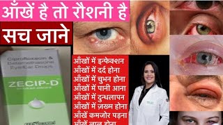 zecip D eye drop uses  price  composition  dose  side effects  review  in hindi [upl. by Alegnaed]