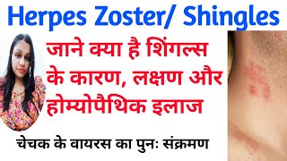 Herpes Zoster Shingles Disease Cause Symptoms And Treatment  Varicella Zoster Virus  शिंगल्स [upl. by Eceinal871]