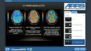 INFARTO E ISQUEMIA CEREBRAL EN TC y RM CURSO NEURORRADIOLOGIA 2 brain ISCHEMIA CT and MRI [upl. by Nettirb]