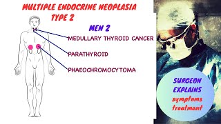 Multiple Endocrine Neoplasia  Type II MEN 2 [upl. by Normie]