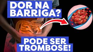 Trombose no intestino Sintomas Diagnóstico e Tratamento Proteja sua Saúde Digestiva Agora [upl. by Hsetim]