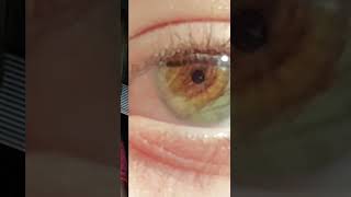 Idk why my eye is so close 😭🫶🏻 trend eyes viralvideo [upl. by Ailemak]