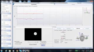 ICS Impulse  Positional Repositioning [upl. by Nedle602]