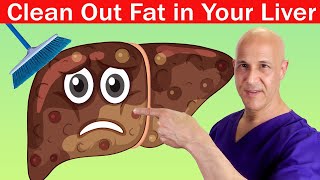 1 Teaspoon Cleans Out Fat in Your Liver  Dr Mandell [upl. by Roberta]