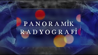 Panoramik Filmde Anatomik Oluşumlar Ve Yorumlama [upl. by Heins638]