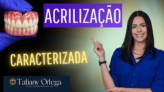 Acrilização de prótese total caracterização natural [upl. by Uyr149]