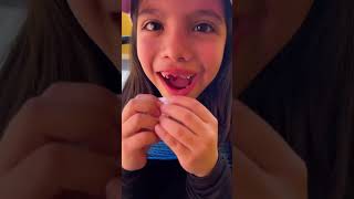 explorepage humor shortsvideo couple family prank dientes [upl. by Tiffany]