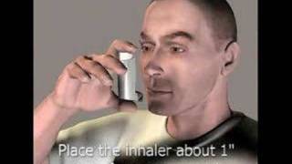 3D Medical Animation Inhaler [upl. by Hammond948]