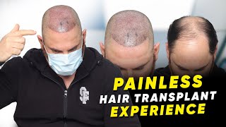 Hair Transplant in Bhopal  Best Results amp Cost of Hair Transplant in Bhopal [upl. by Aynekal242]