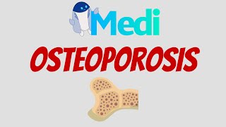 ¿Cuándo tamizar Osteoporosis [upl. by Jeggar120]