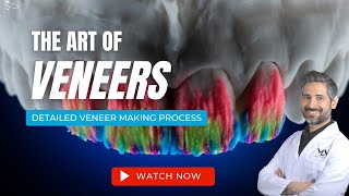 Making Porcelain Veneers  The Art of Veneers [upl. by Knight]