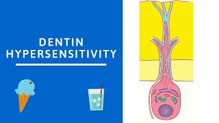 Dentin hypersensitivity Dentin Pulp Complex Session 8 [upl. by Lednik]