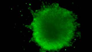 Neuronal firing in different mouse primary neural stem cell spheres visualized by calcium imaging [upl. by Adnahcal]