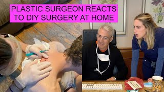 PLASTIC SURGEON REACTS to DIY CYST REMOVAL [upl. by Kcinnay]