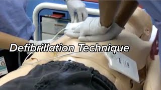 How to Defibrillate  Defibrillation Technique [upl. by On812]