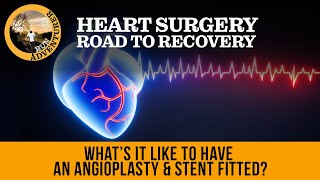 Whats it like to have an angioplasty amp stent fitted a patients perspective of heart surgery [upl. by Reeves]