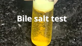 Bile Salt Test [upl. by Ayekahs782]