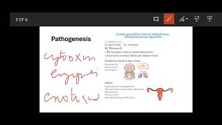 Group B Streptococcus  propertiesDiseasesClinical Featureslab diagnosisTreatment micro mbbs [upl. by Warfourd]