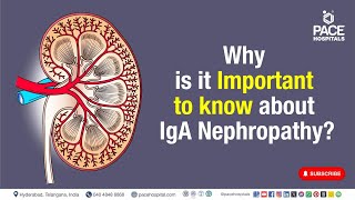 IgA Nephropathy Important  Why is it Important to know about IgA Nephropathy  iganephropathy [upl. by Oluap]