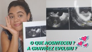 Gravidez Anembrionária  aborto espontâneo  Meu Relato [upl. by Weide]