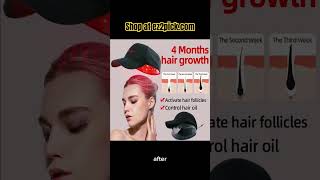 Boost Hair Growth Advanced Laser Cap Technology” HairGrowth LaserTherapy [upl. by Eltsryk]