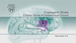 Embolic Stroke of Undetermined Source ESUSCryptogenic Stroke by Deena M Nasr DO  Preview [upl. by Ennagem]