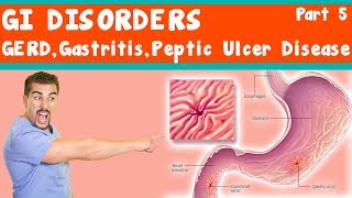 GI Disorders GERD Gastritis peptic ulcer Disease Part 5 [upl. by Pietro]