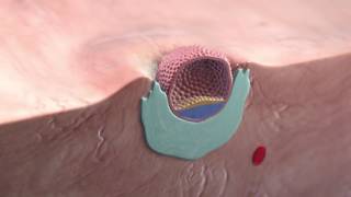 Implantation of the blastocyst [upl. by Okia]