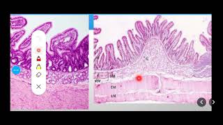 Histology Slides Series Episode 10  Histology of the Small Intestine Duodenum Jejunum Ileum [upl. by Slavic]