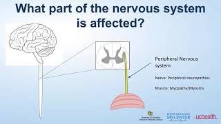 Neuroimmunology Nuggets Neurosarcoidosis [upl. by Ambrosia568]