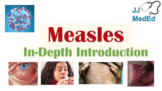 Introduction to Measles  Causes Risk Factors Transmission Stages of Infection Signs amp Symptoms [upl. by Calendra]