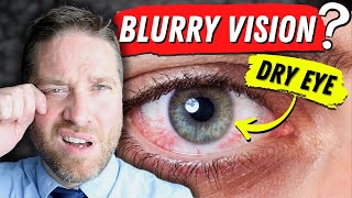 Why Dry Eyes Cause Blurry Vision  3 Reasons And 3 Home Remedies [upl. by Id625]