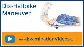 Dix Hallpike Maneuver [upl. by Amme]