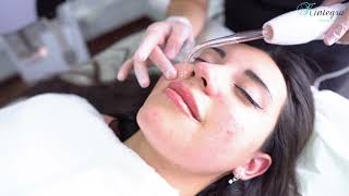 Limpieza Facial Profunda Profesional [upl. by Sandi]