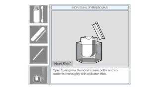 Individual Syringoma Removal at Home [upl. by Ecadnarb]