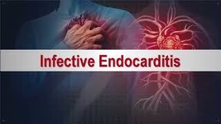 Infective Endocarditis  التهاب شغاف القلب [upl. by Navada]