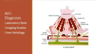 Autoimmune Hepatitis in Children Approach to Treatment and What to Expect [upl. by Yule]