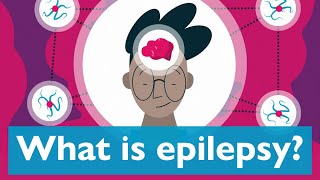 What is epilepsy [upl. by Kurtzig345]