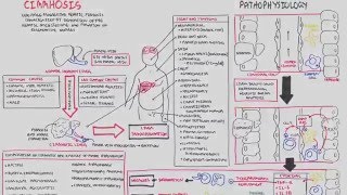 Liver Cirrhosis SandS Pathophysiology Investigations Management [upl. by Arihsaj]