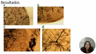 Privación sensorial ansiedad conducta social y cognición en la rata implicaciones en salud mental [upl. by Zug]