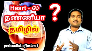 Pericardial Effusion in tamil  Heart Problem in tamil  ECG ECHO in tamil [upl. by Mir]