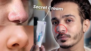 OMG This Cream Erases Blackheads amp Whiteheads Like Magic 😱 [upl. by Noicpesnoc]