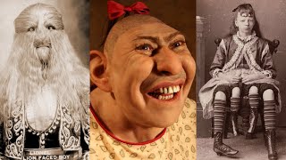 8 Legendary CIRCUS FREAKS  The Shocking Stories MindBlowing [upl. by Idnil144]