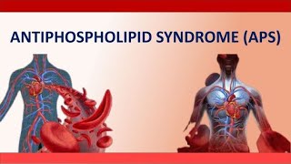 Antiphospholipid Syndrome APS  What Is APS and how to Manage It during Pregnancy [upl. by Nnylav]