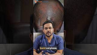 Diagnosis amp Treatment of Scarring Alopecia  Dr Alok Sahoo  alloroots [upl. by Ahsieken353]