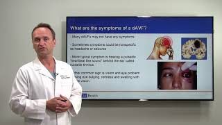 Brain Arteriovenous Fistula Diagnosis and Treatment  Viktor Szeder MD PhD  UCLAMDChat [upl. by Ednarb]