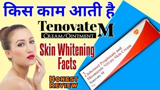 Tenovate M Skin Cream Ke Fayde  Clobetasol amp Miconazole Ointment For Fungal Infection In Hindi [upl. by Anu617]