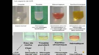 Examen cytobactériologique du liquide céphalorachidien LCR final [upl. by Leckie688]