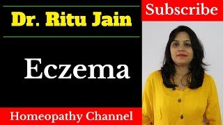 एक्जिमा का इलाज  Homeopathic Medicine amp Treatment For Eczema in Hindi How to cure eczema fast [upl. by Marcella]